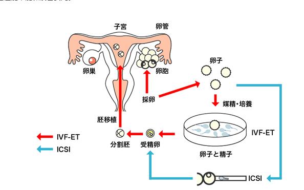 第三方供卵试管(第三方供卵试管：新生命的希望)