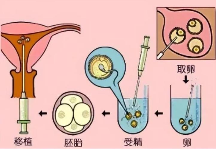 供卵的孩子是亲生的吗【供卵的孩子是亲生的吗?真相揭秘】
