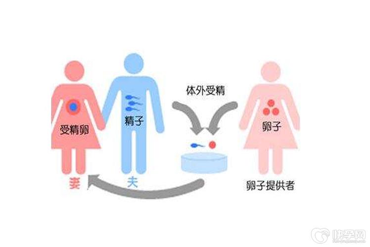 供卵试管需要什么条件-供卵试管:条件是什么?